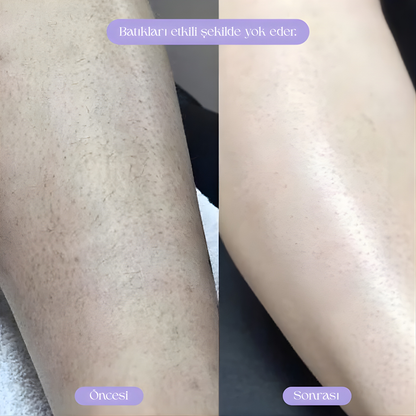 HAIRLORA- Kristal Kıl Silgisi